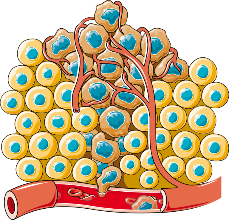 Cancerous cell - Servier Medical Art