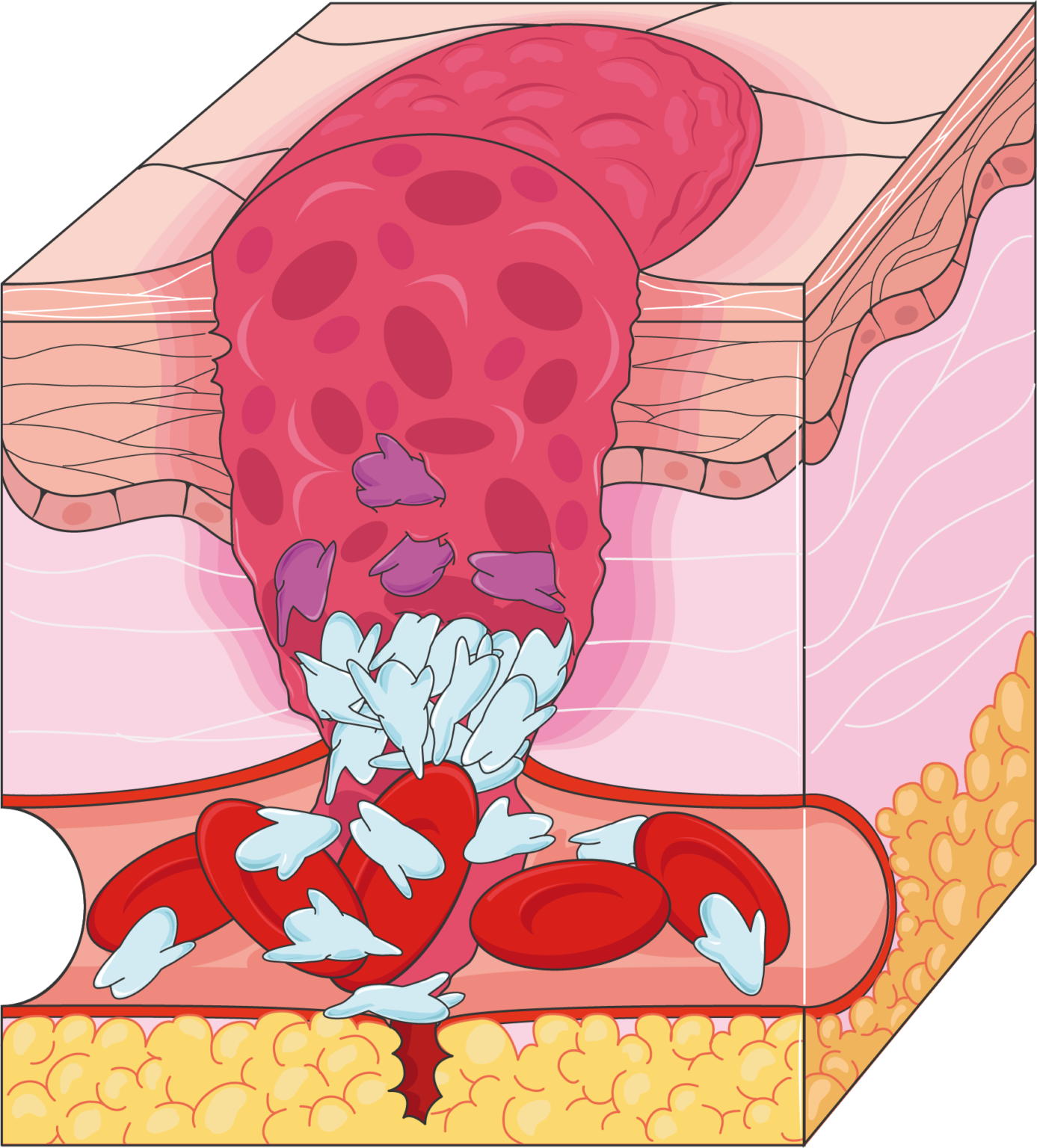 heart-pericardium-servier-medical-art