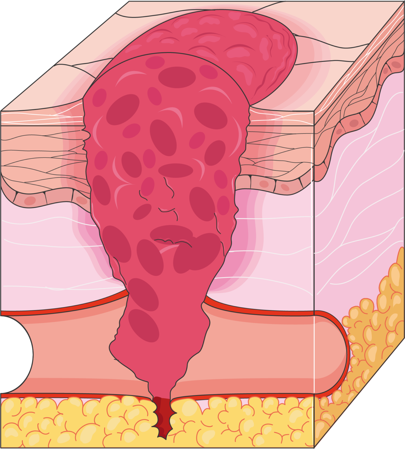 Immunology and haematology Servier Medical Art