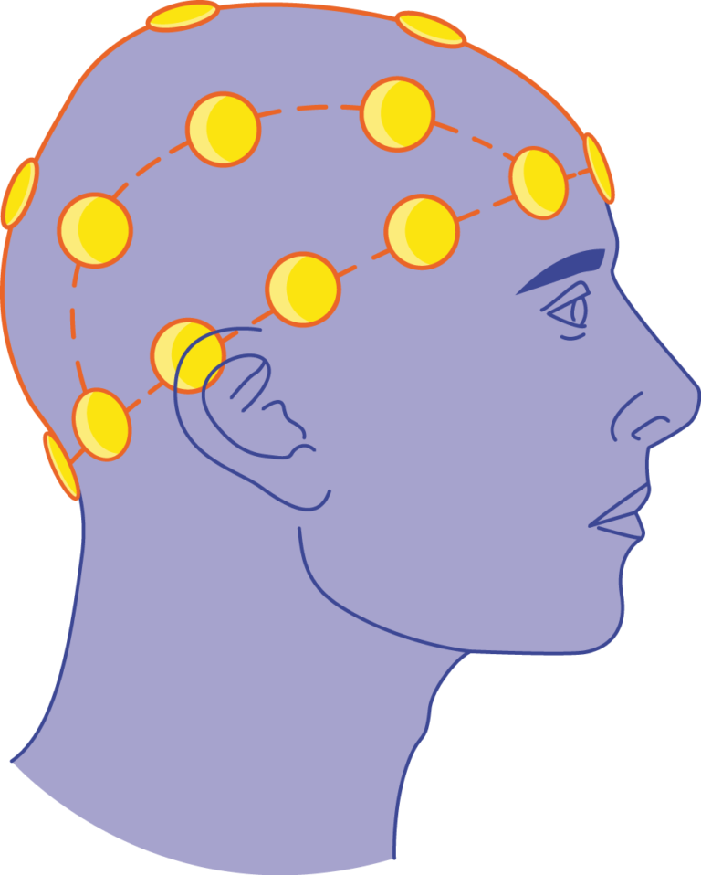 Vacuum flask Servier Medical Art