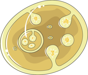 echinococcus kyste hydatique
