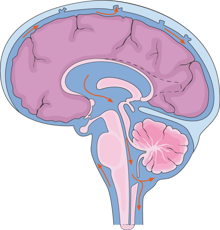 cerebrospinal fluid leak prognosis