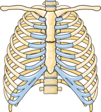 Oblique fracture - Servier Medical Art