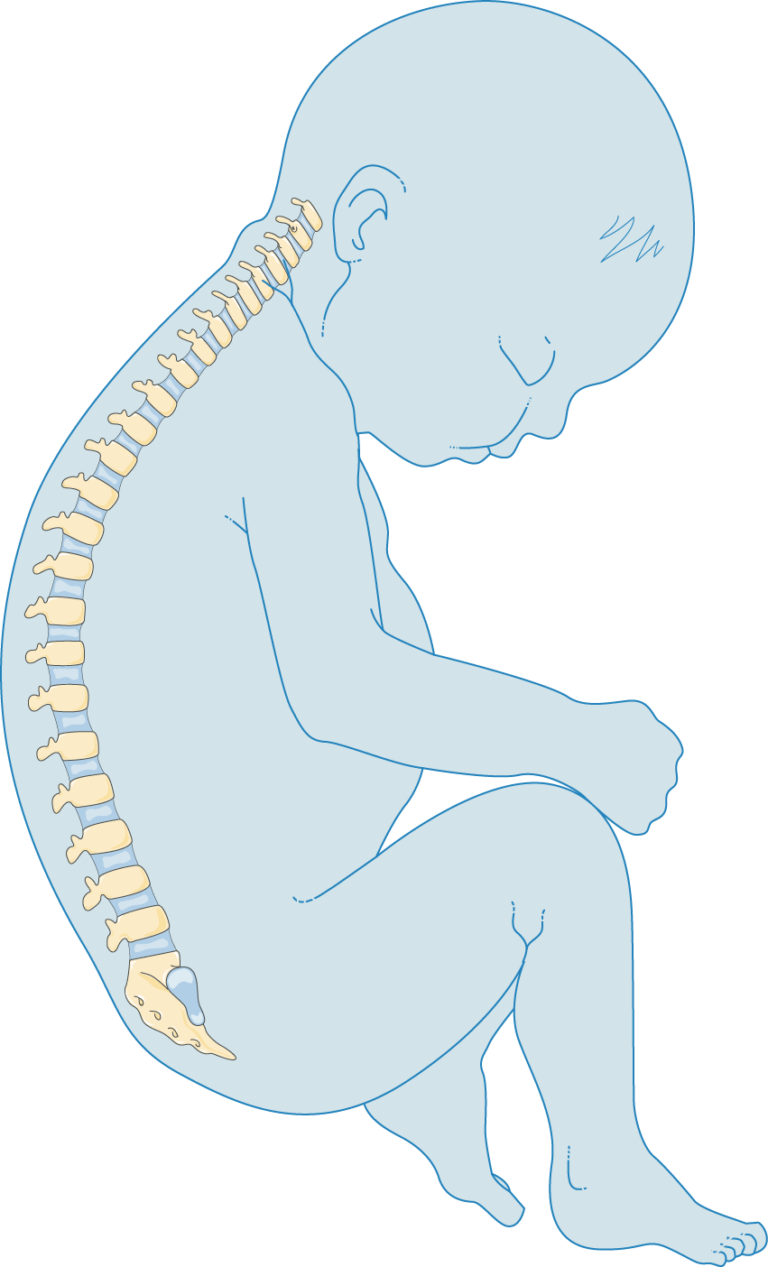 Vertebral Column Disorders Scoliosis Servier Medical Art