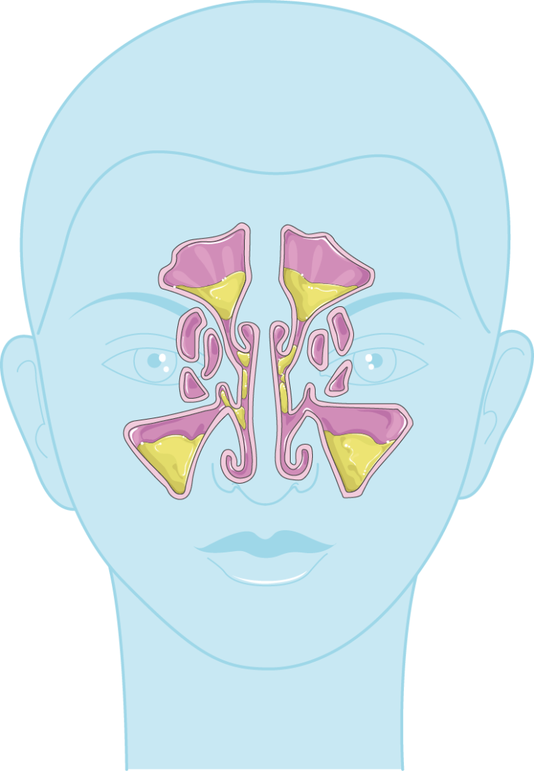 Olfactory bulb - Servier Medical Art