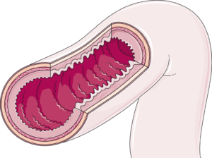 coupe intestin
