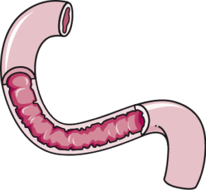 duodenum coupe