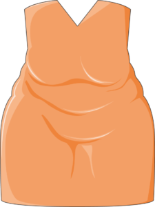 Femme obèse robe