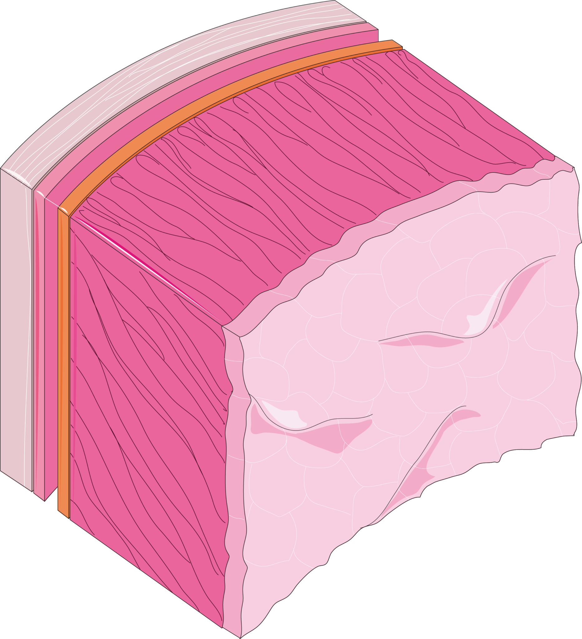 endocarditis-servier-medical-art